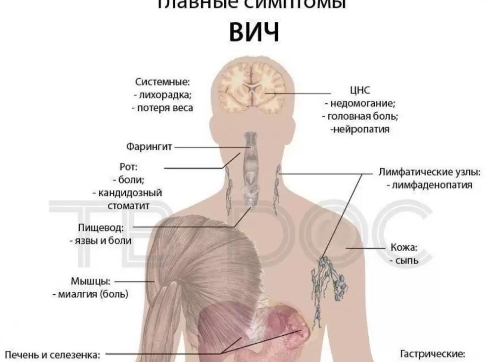 Через сколько дней проявляется вич
