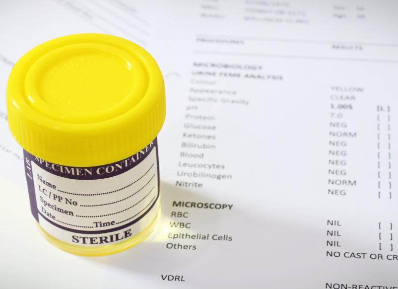 Аппаратный анализ мочи расшифровка