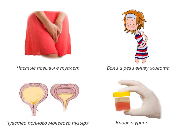 Как делают узи мочевого пузыря у женщин