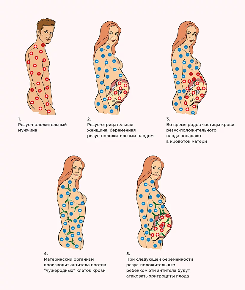 Мать резус положительный отец отрицательный