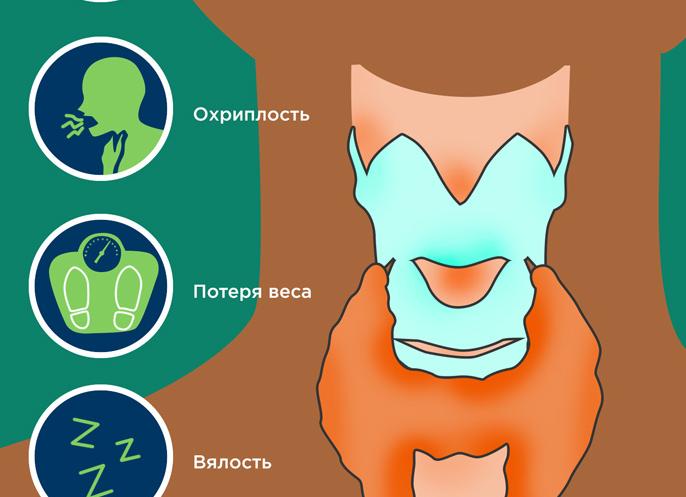 Медуллярный рак щитовидной железы прогноз после операции Медуллярный рак щитовидной железы прогноз после операции