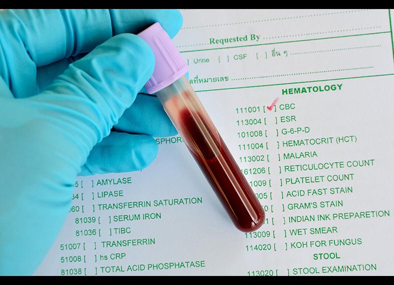 Кровь из пальца что показывает