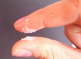 Кремообразные выделения без запаха