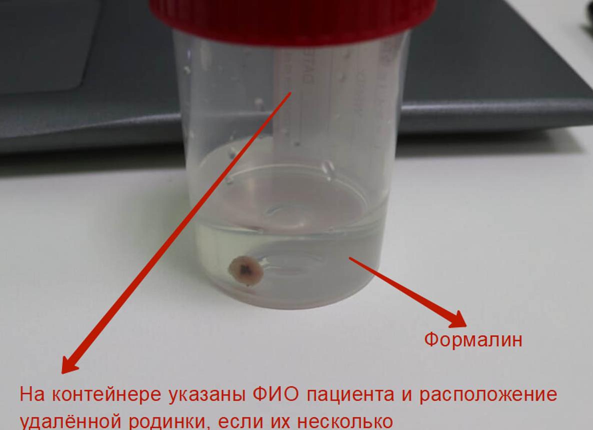 Гистология сколько дней делается анализ