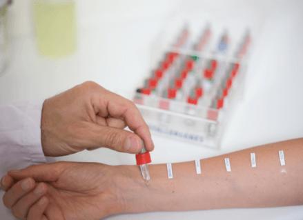 Где сдать анализы на аллергены