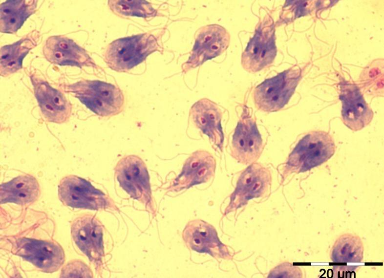 Анализ на цисты лямблий