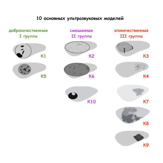 Гипоэхогенное образование щитовидной железы что это такое