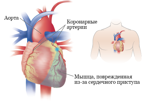 Мало тромбоцитов в крови у ребенка что это значит