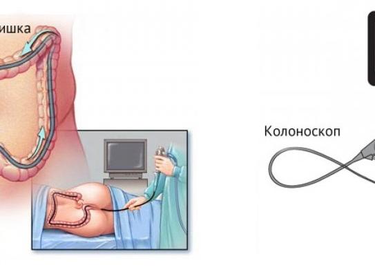 Как проводится узи кишечника