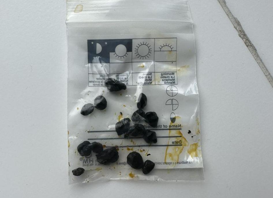 К желчным пигментам относится