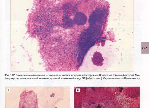 Грамвариабельная бактериальная флора