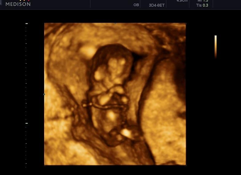 Фото 12 недель