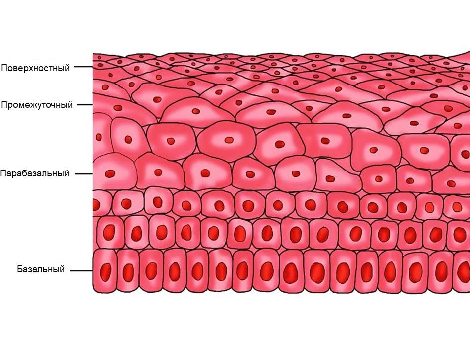 Эпителий плоский поверхностного слоя в мазке