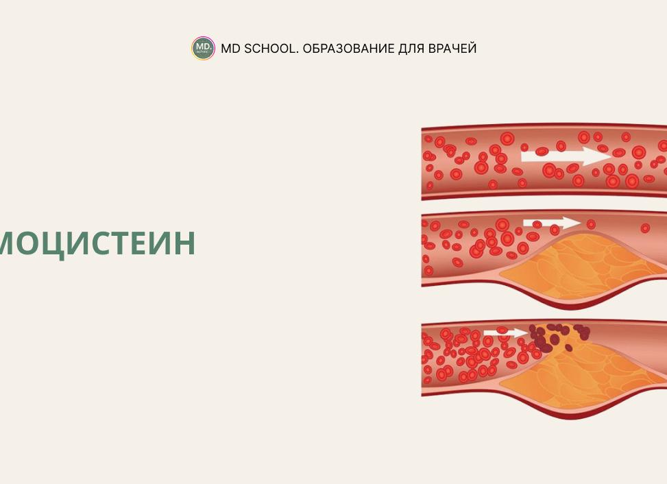 Что такое гомоцистеин в анализе крови