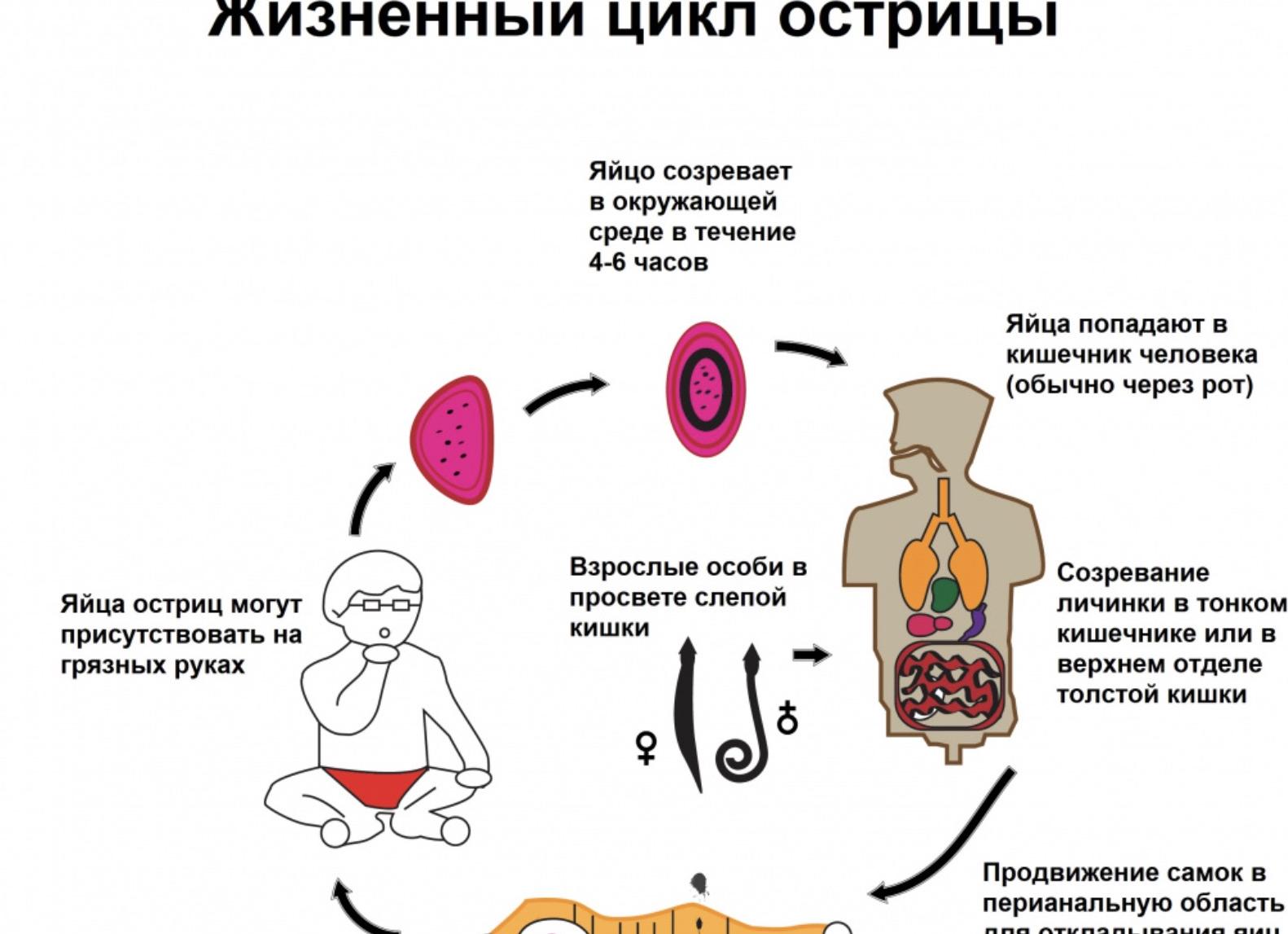 Что такое энтеробиоз у детей фото Что такое энтеробиоз у детей фото