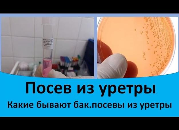 Бак посев из уретры у мужчин что показывает