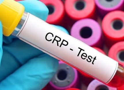 Анализ срп что это