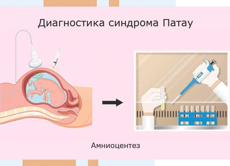 Анализ скрининг что это
