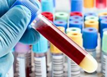 Анализ крови лдг что это такое