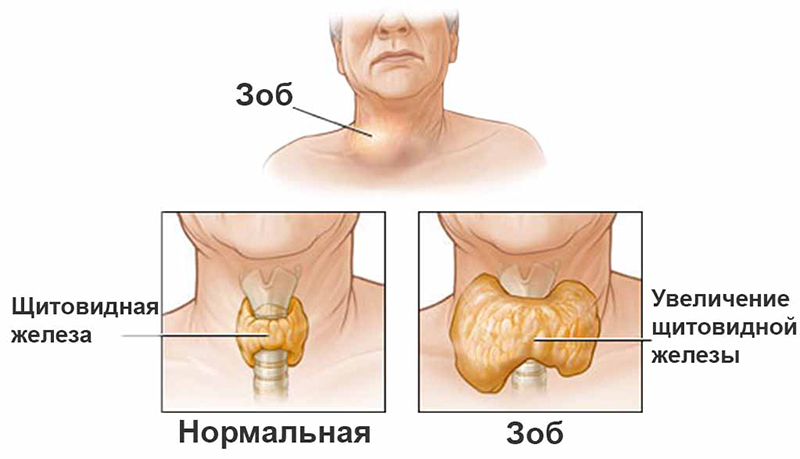 Как проходит узи щитовидной железы