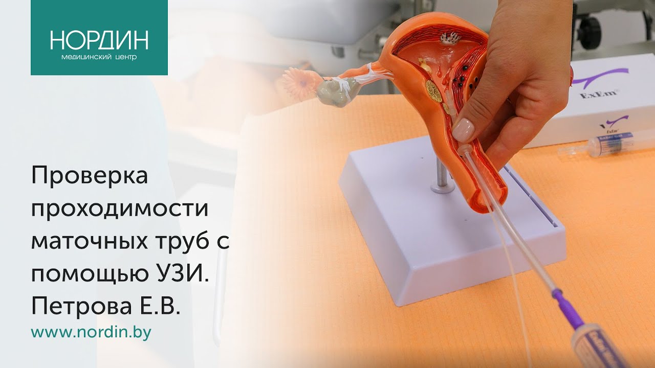 Как проверить проходимость маточных труб с помощью узи