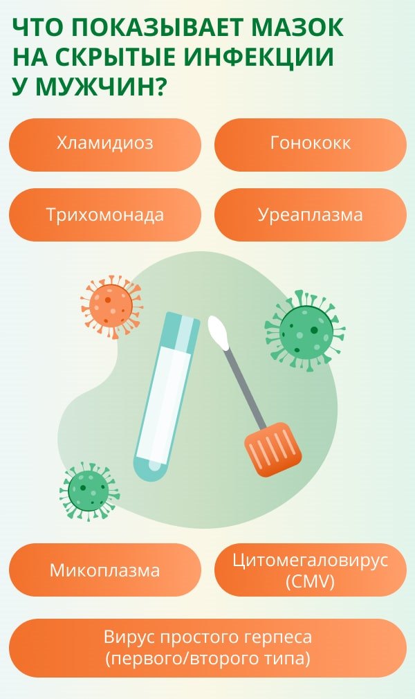 Мазок у мужчин на инфекции
