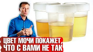 Моча лимонного цвета у женщин причины