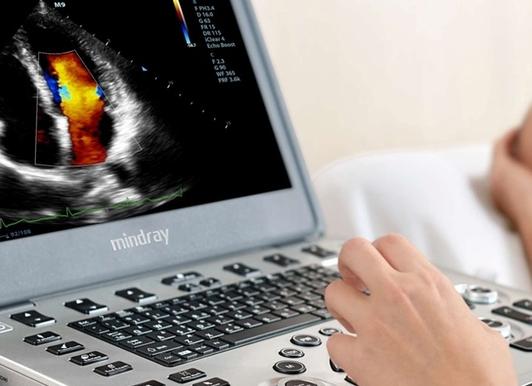 На дому узи сердца