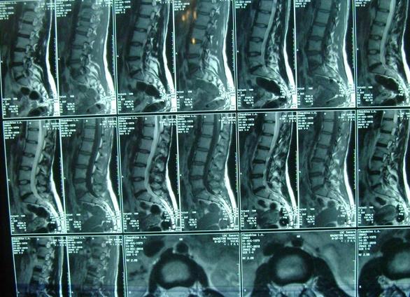 Мрт в каких случаях делают