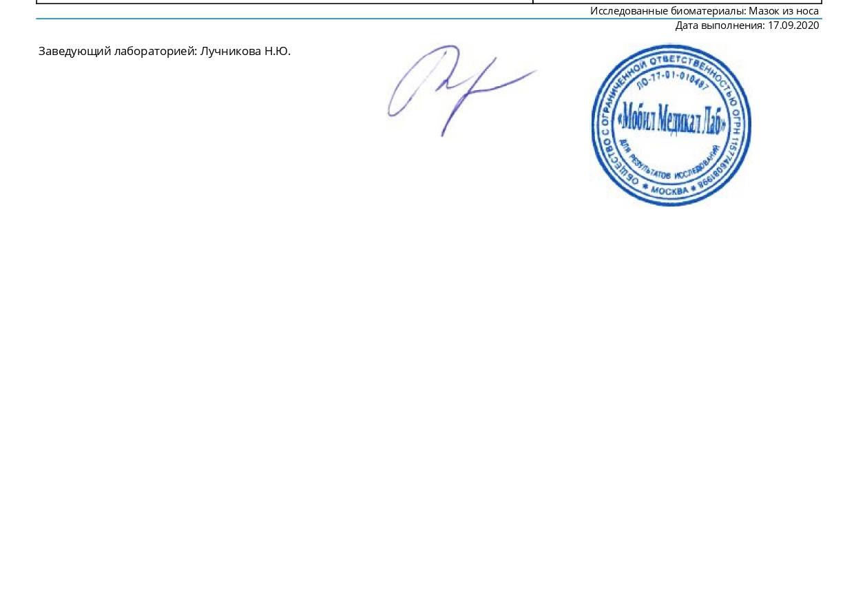 Мазок из зева на дифтерию