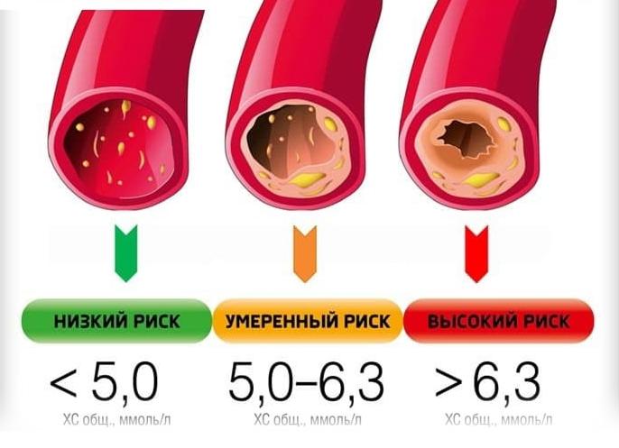 Лпнп и лпвп