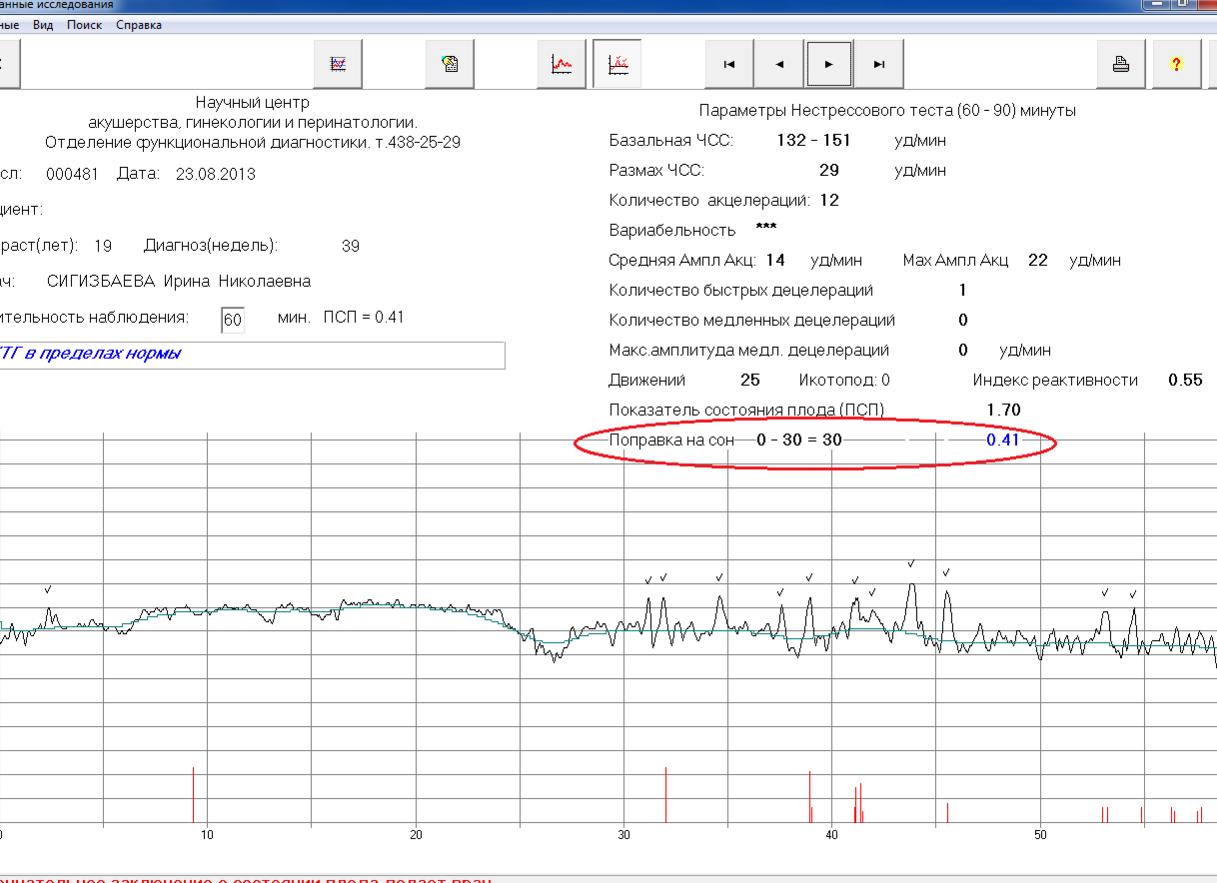 Ктг количество акцелераций