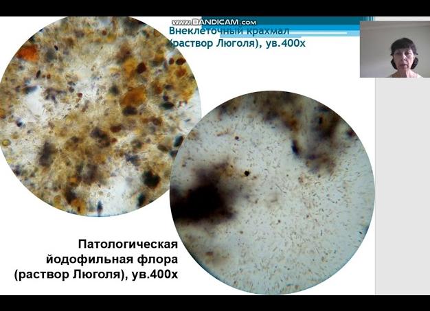 Йодофильная флора в кале что это