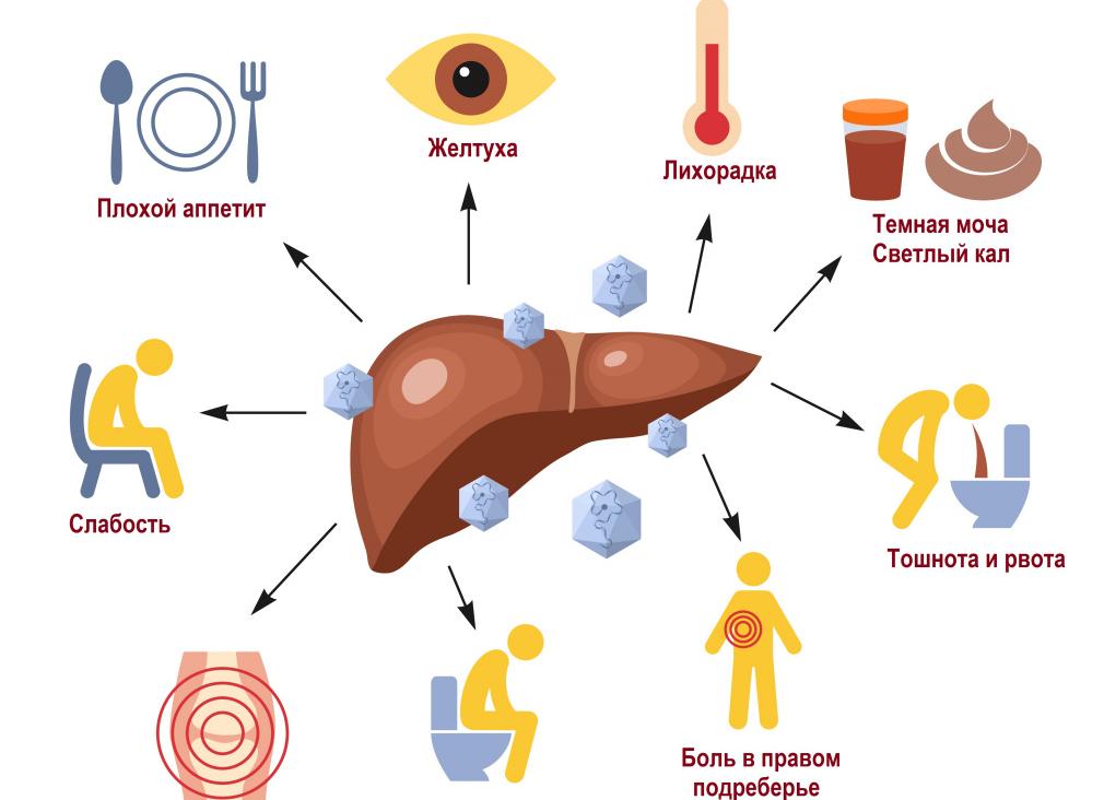 Гепатит а это желтуха или нет Гепатит а это желтуха или нет