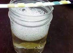 Если в моче сода не шипит