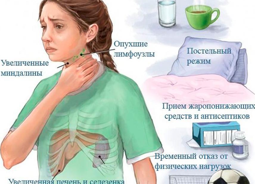 Диагностика инфекционного мононуклеоза