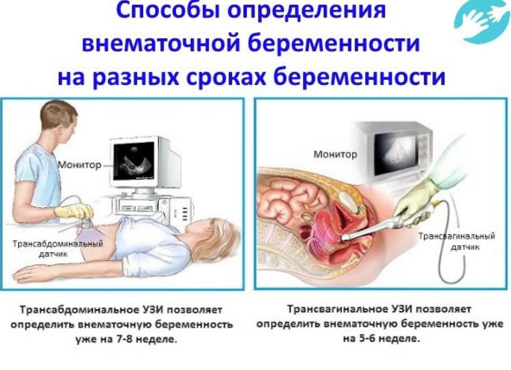 Что такое трансабдоминальное узи малого таза