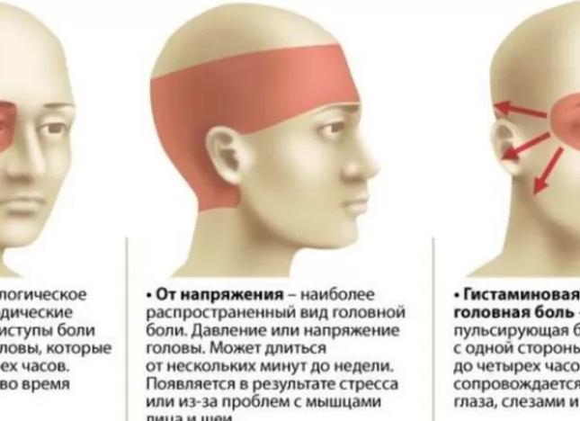 Болит голова после физической нагрузки