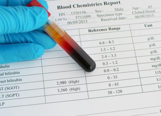 Биохимия при онкологии