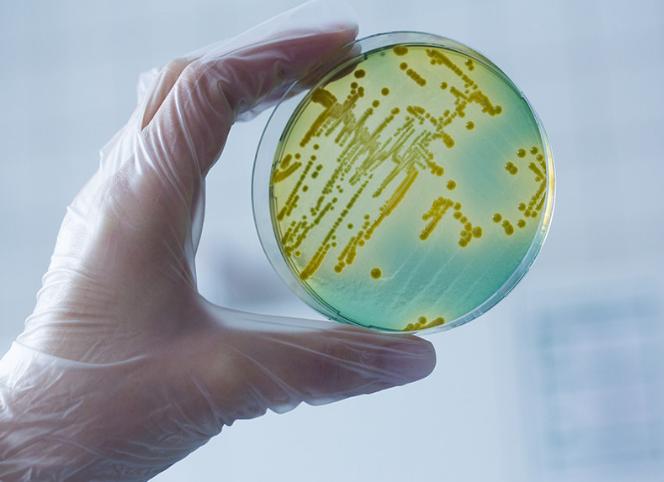 Бактериологическое исследование мочи