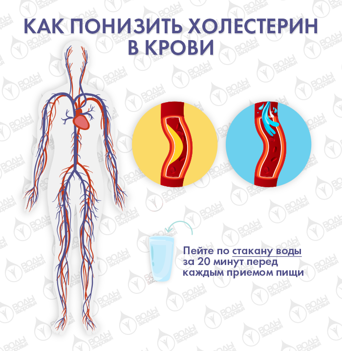 Как быстро снизить холестерин