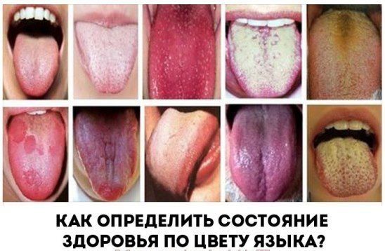 Как определить болезнь