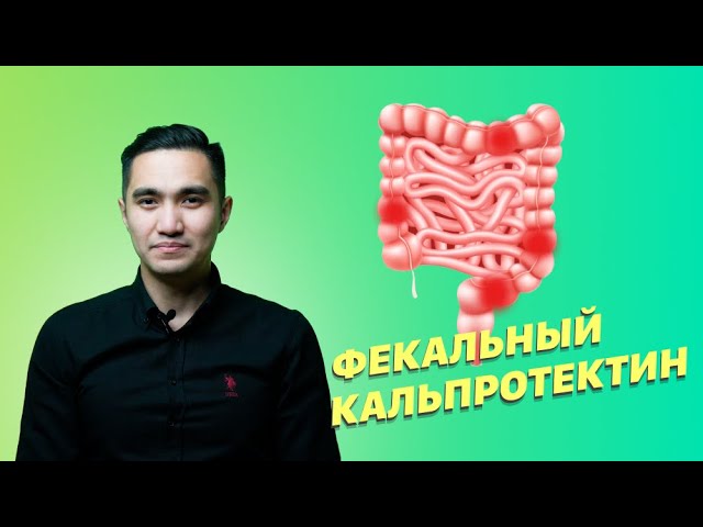 Кальпротектин фекальный что