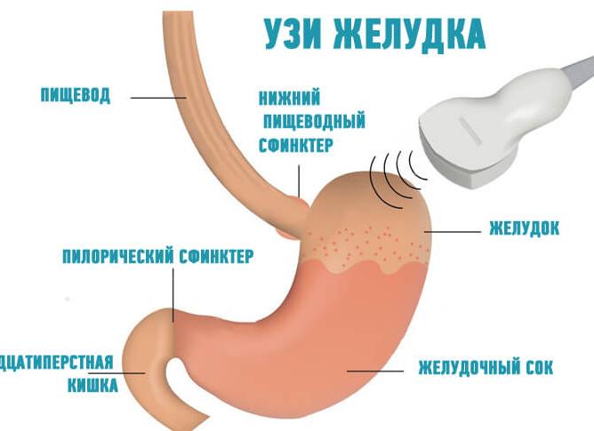 Можно ли сделать узи желудка Можно ли сделать узи желудка