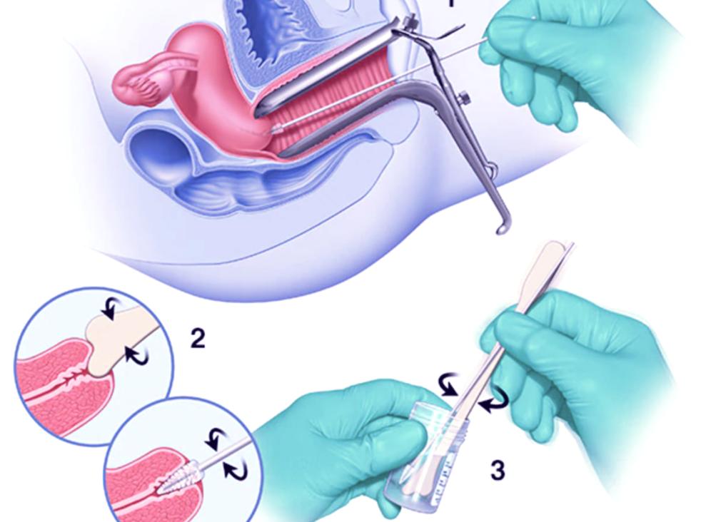 Можно ли сдать мазок флору