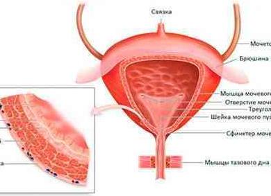 Карцинома мочевого пузыря что это такое и сколько проживет человек Карцинома мочевого пузыря что это такое и сколько проживет человек