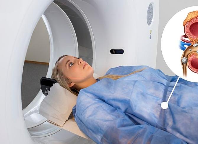 Как подготовиться к кт почек с контрастированием Как подготовиться к кт почек с контрастированием