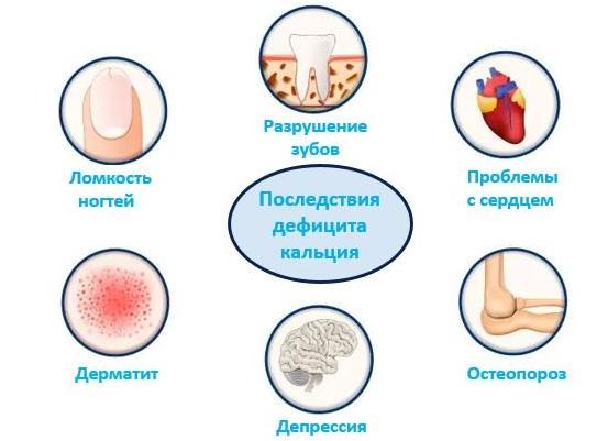Как определить дефицит кальция в организме