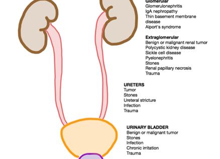 Эритроциты в моче 1250 по нечипоренко