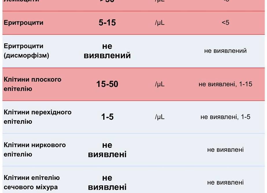 Эпителий плоский в моче повышен у ребенка